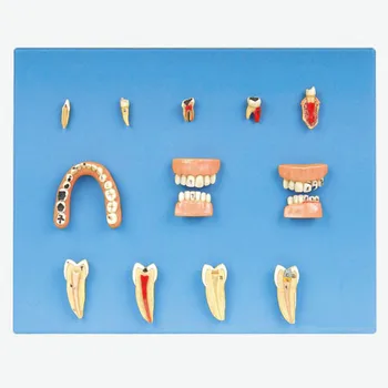 Boli Dentare Model